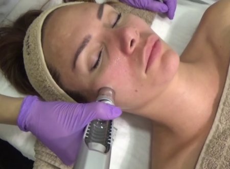 İğnesiz Mezoterapi